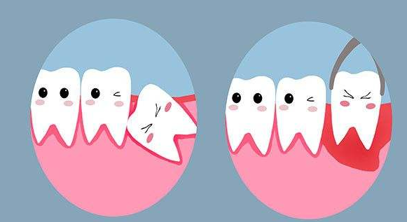 智齿会对口腔造成什么影响